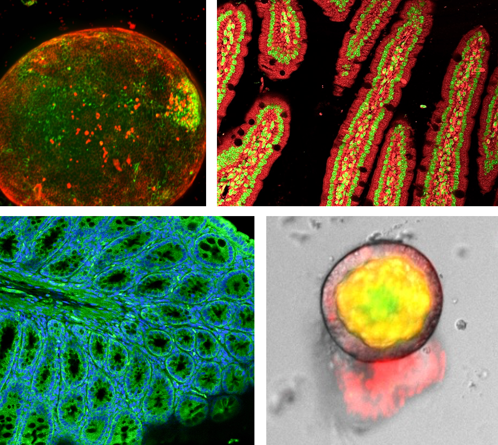 Microscopies of cells