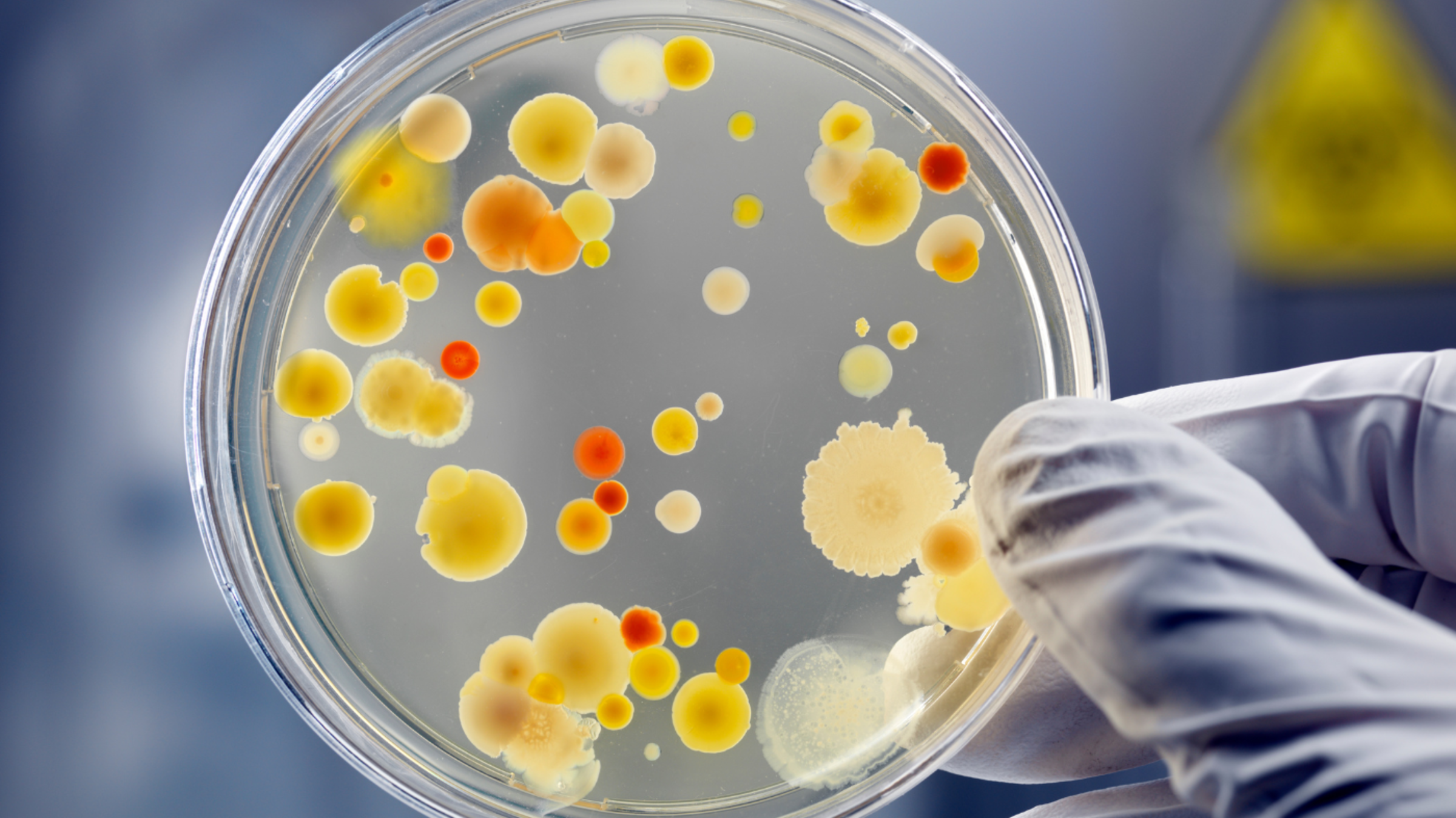 a gloved hand holding a petri dish with bacteria culture