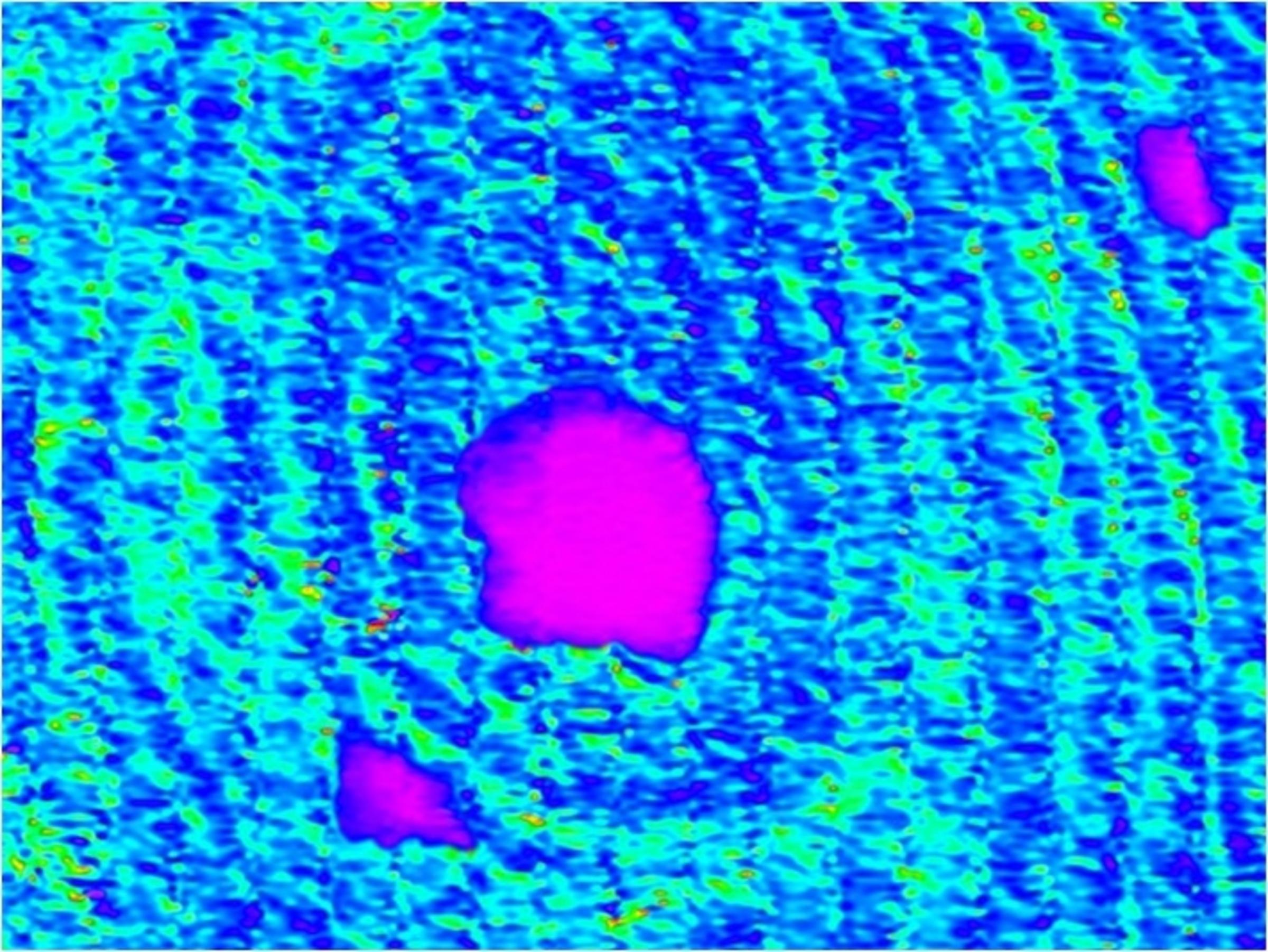 A blue, green, and pink microscopy image that looks like circles making a ripple.