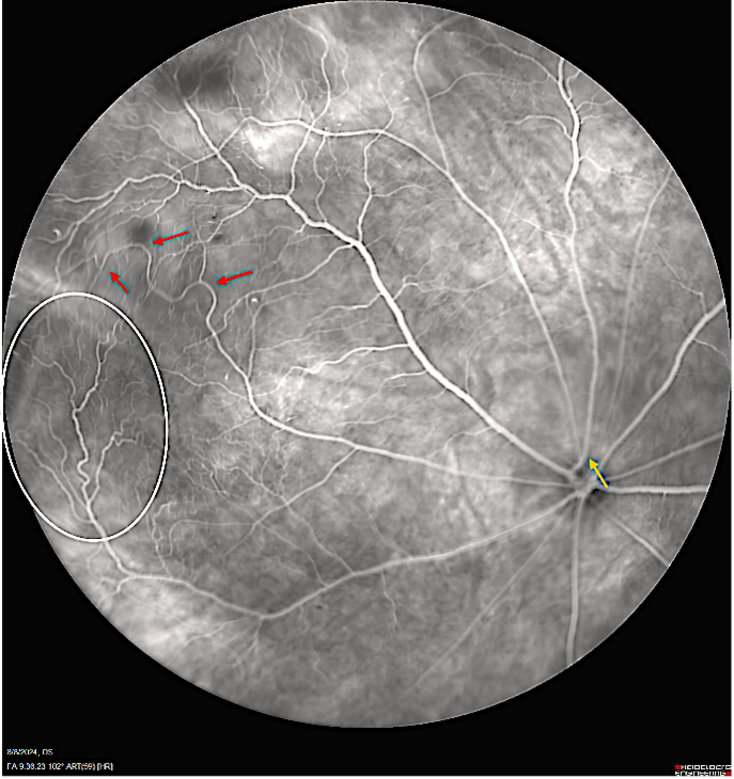 Image of an animal eye with ROP eye disorder