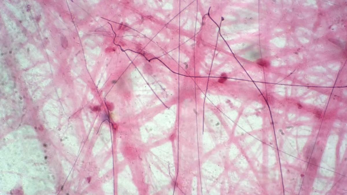 Tissue Engineering