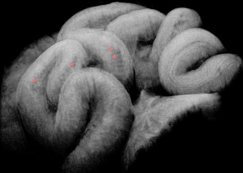 Researchers use OCT imaging to uncover how the fallopian tube transports embryos