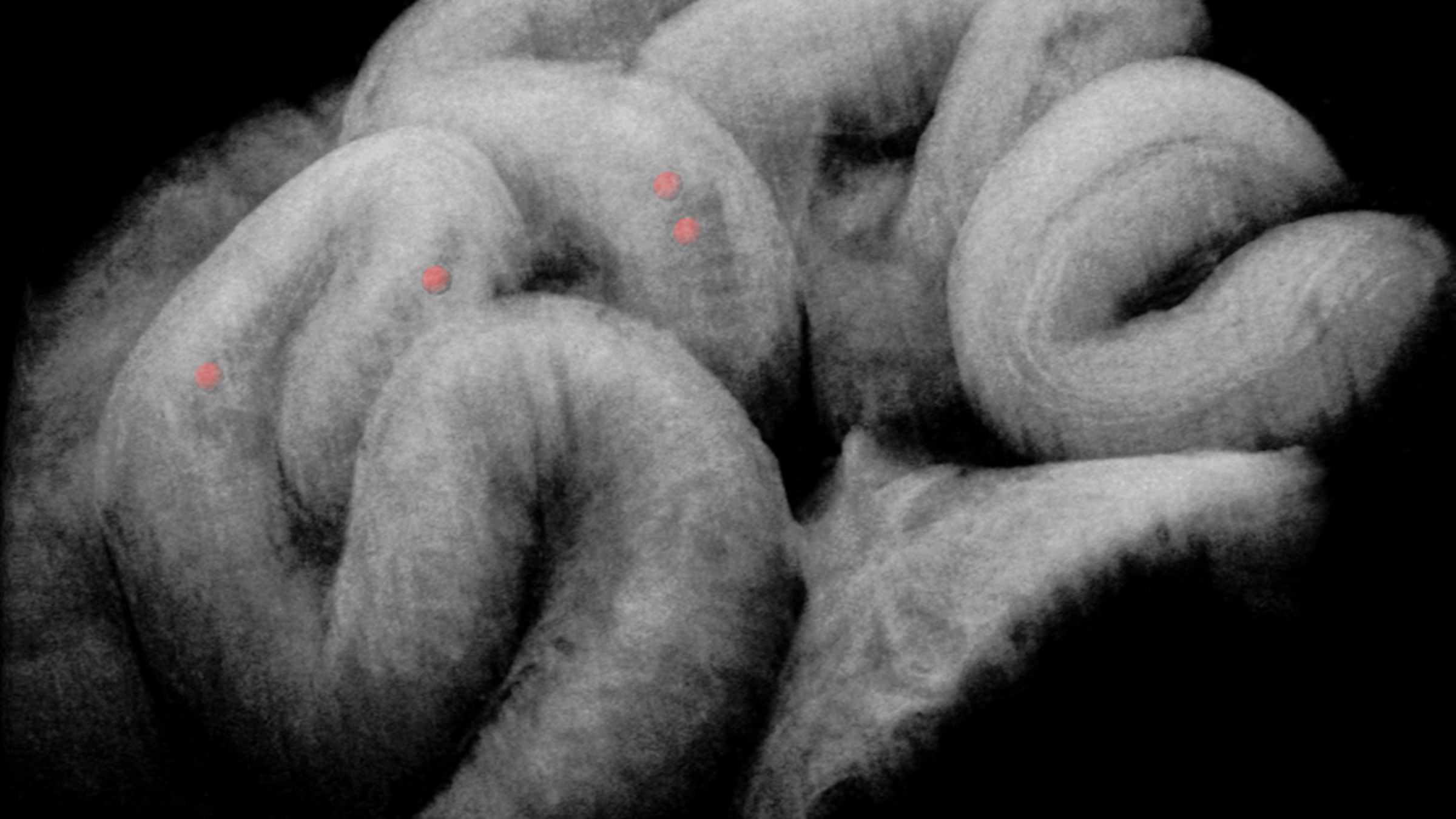 Researchers use OCT imaging to uncover how the fallopian tube transports embryos