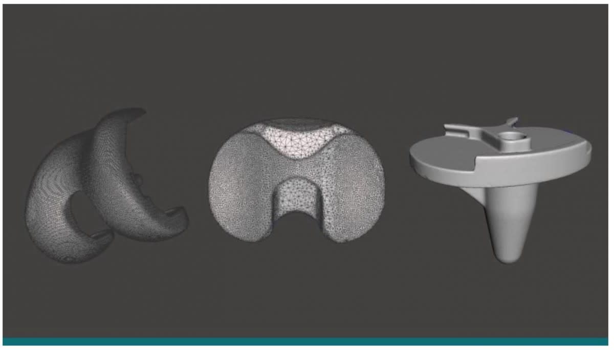 3D Model of OrthoInsight