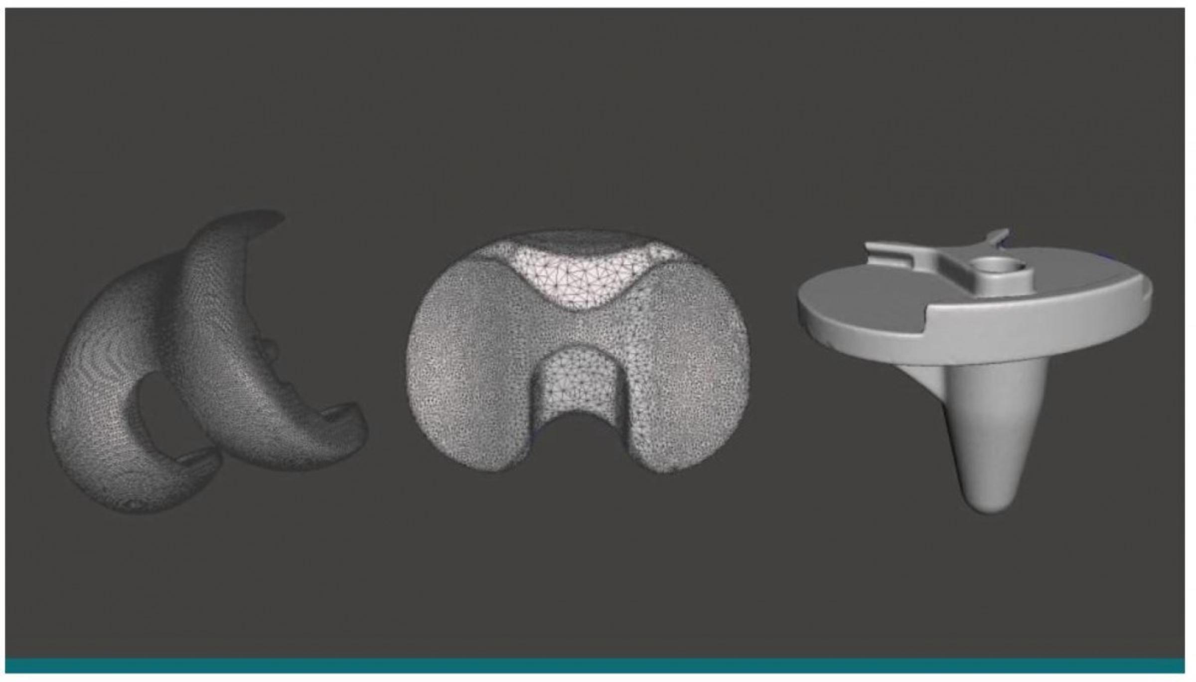 3D Model of OrthoInsight