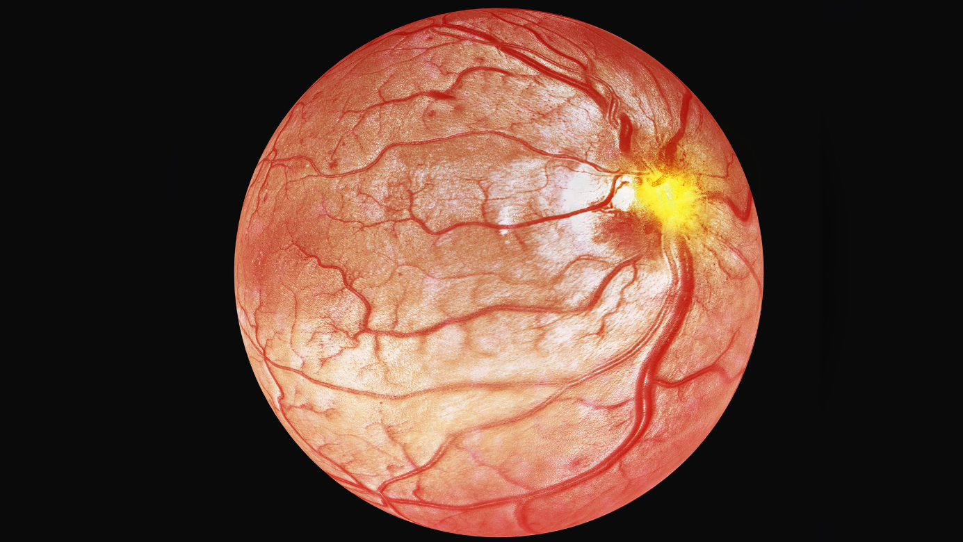 3D illustration of optical coherence tomography.
