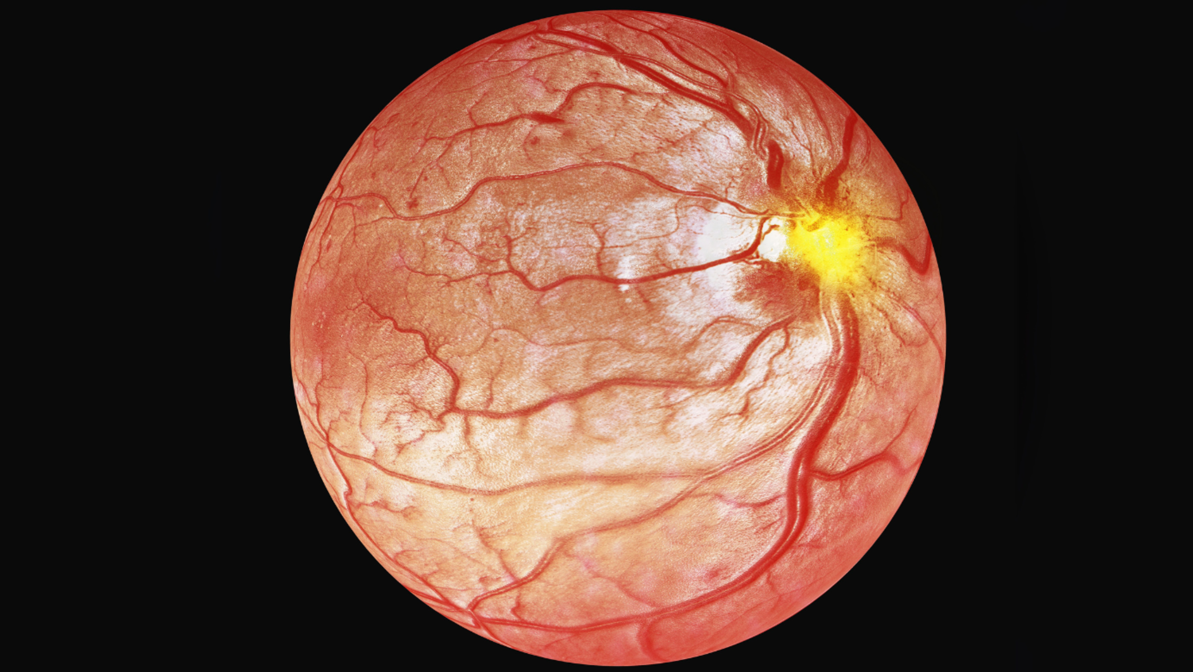 3D illustration of optical coherence tomography.