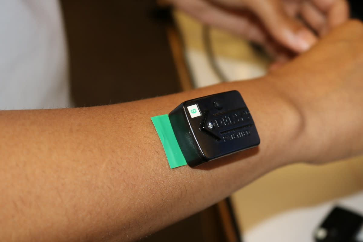 A sensor Patel uses to monitor hand movements.