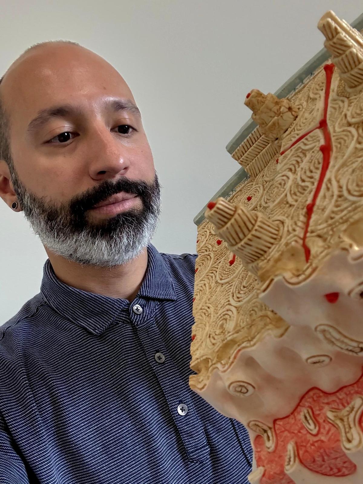 William Querido, from the shoulders up, looks at a large model of a cross section of a bone, which he is holding.
