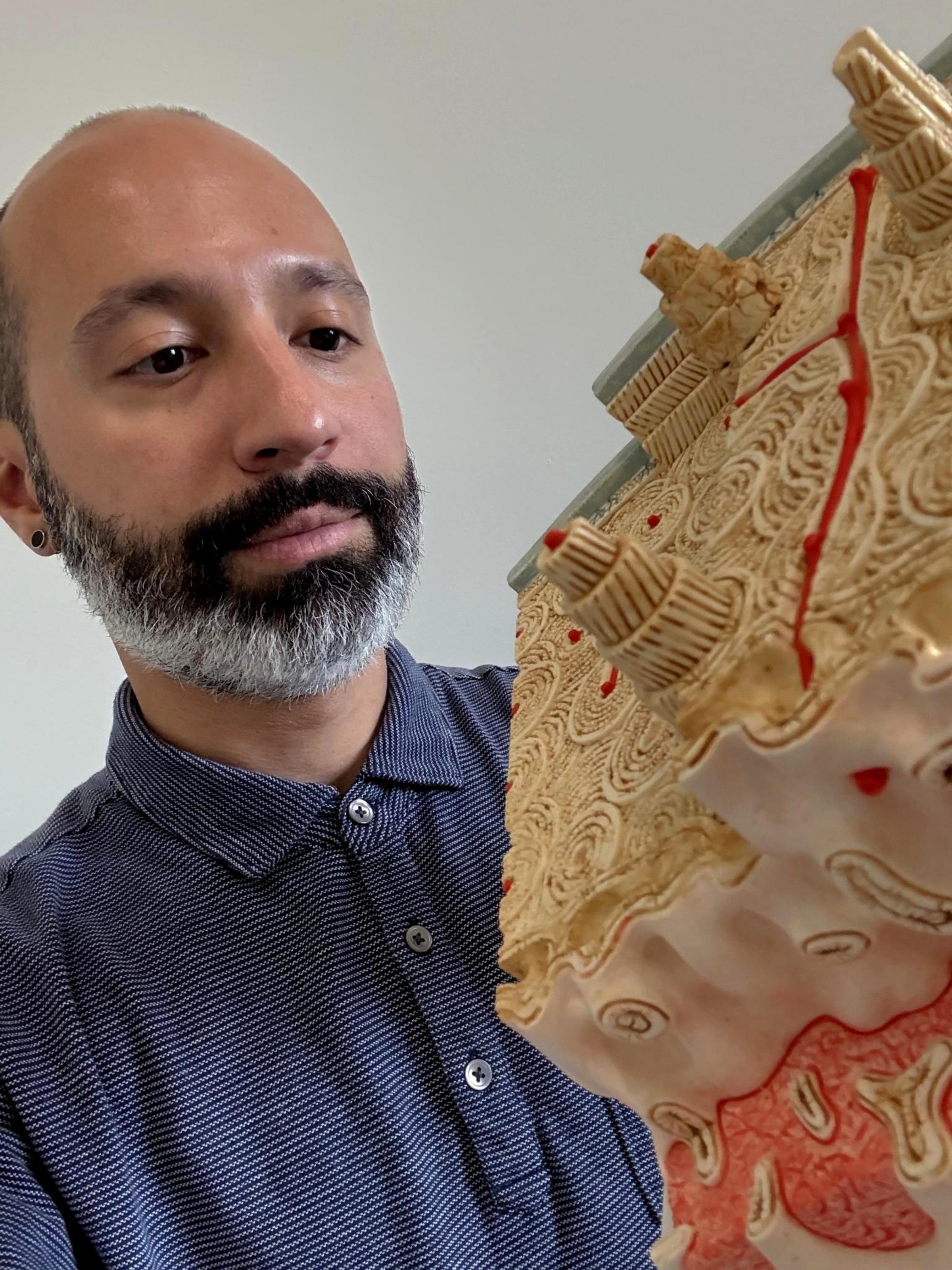William Querido, from the shoulders up, looks at a large model of a cross section of a bone, which he is holding.