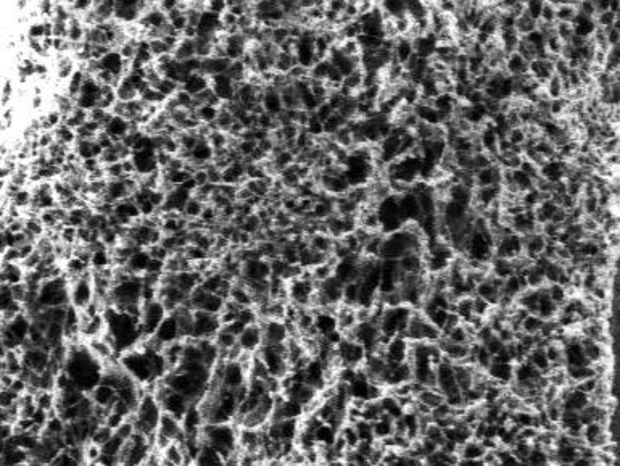 Cryogen-based scanning electron micrograph of a light harvesting polymer gel network that leads to doubling of the efficiency of flexible solar panels. CREDIT: Stephanie Lee