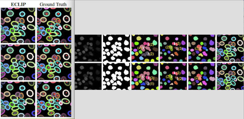 An example of a tracking technique using sources like medical images 