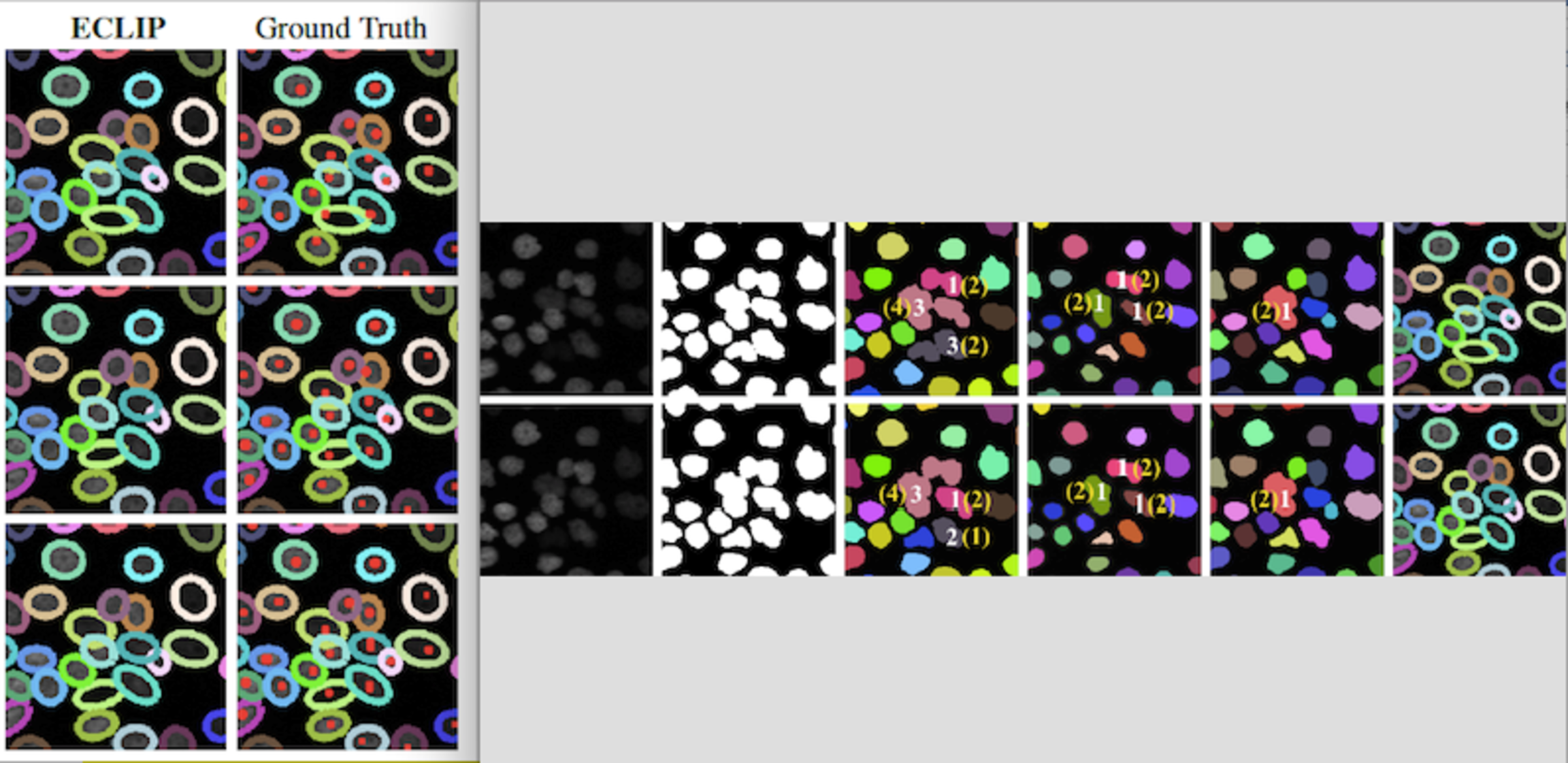 An example of a tracking technique using sources like medical images