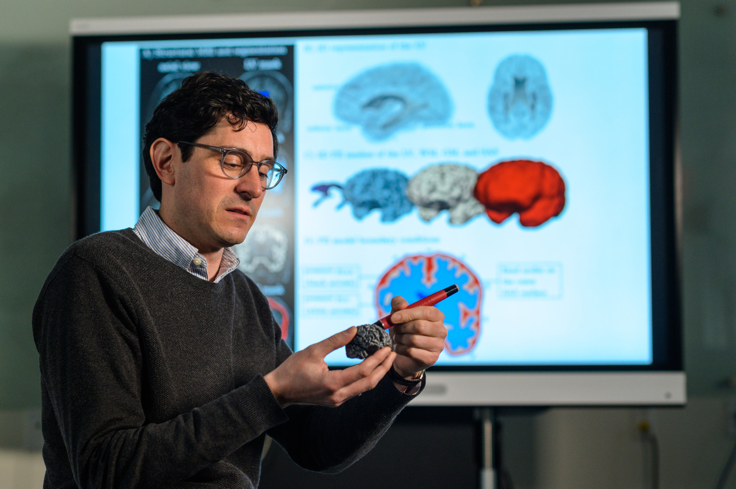 Johannes Weickenmeier standing in front of a screen with images of brains, pointing to an area of a model brain