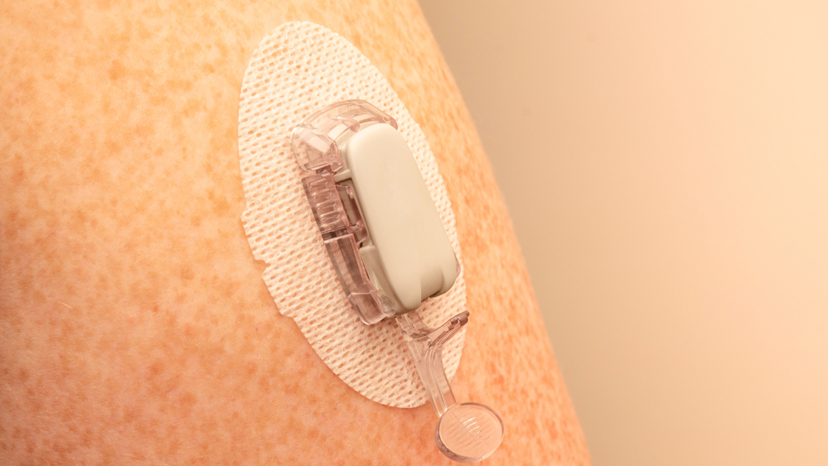 Close-up of a soft glucose monitor on a person's arm.