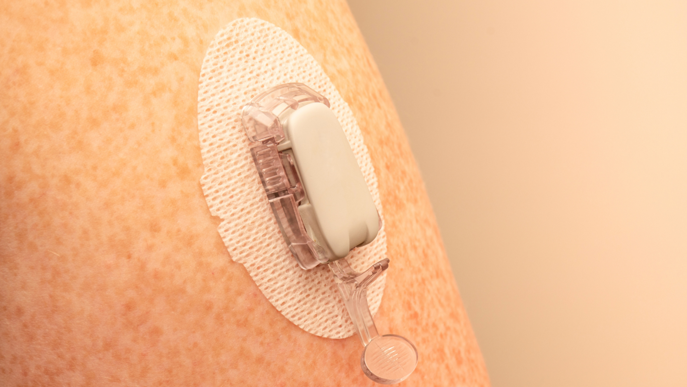 Close-up of a soft glucose monitor on a person's arm.