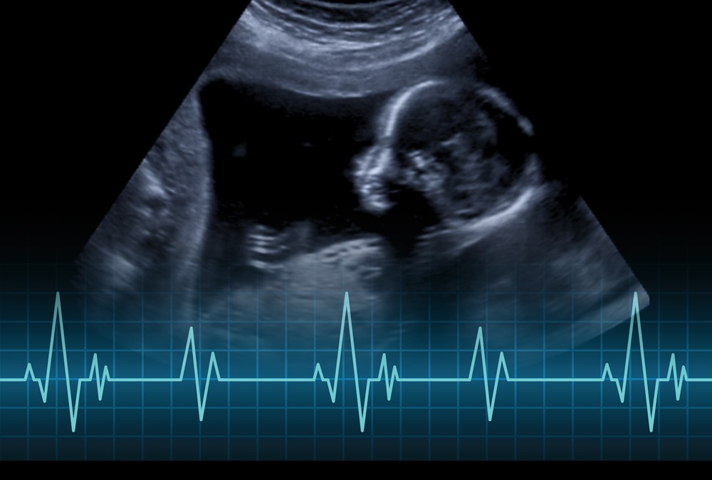 An ultrasound image of a baby in utero in the third trimester, with EKG spikes toward the bottom of the image.
