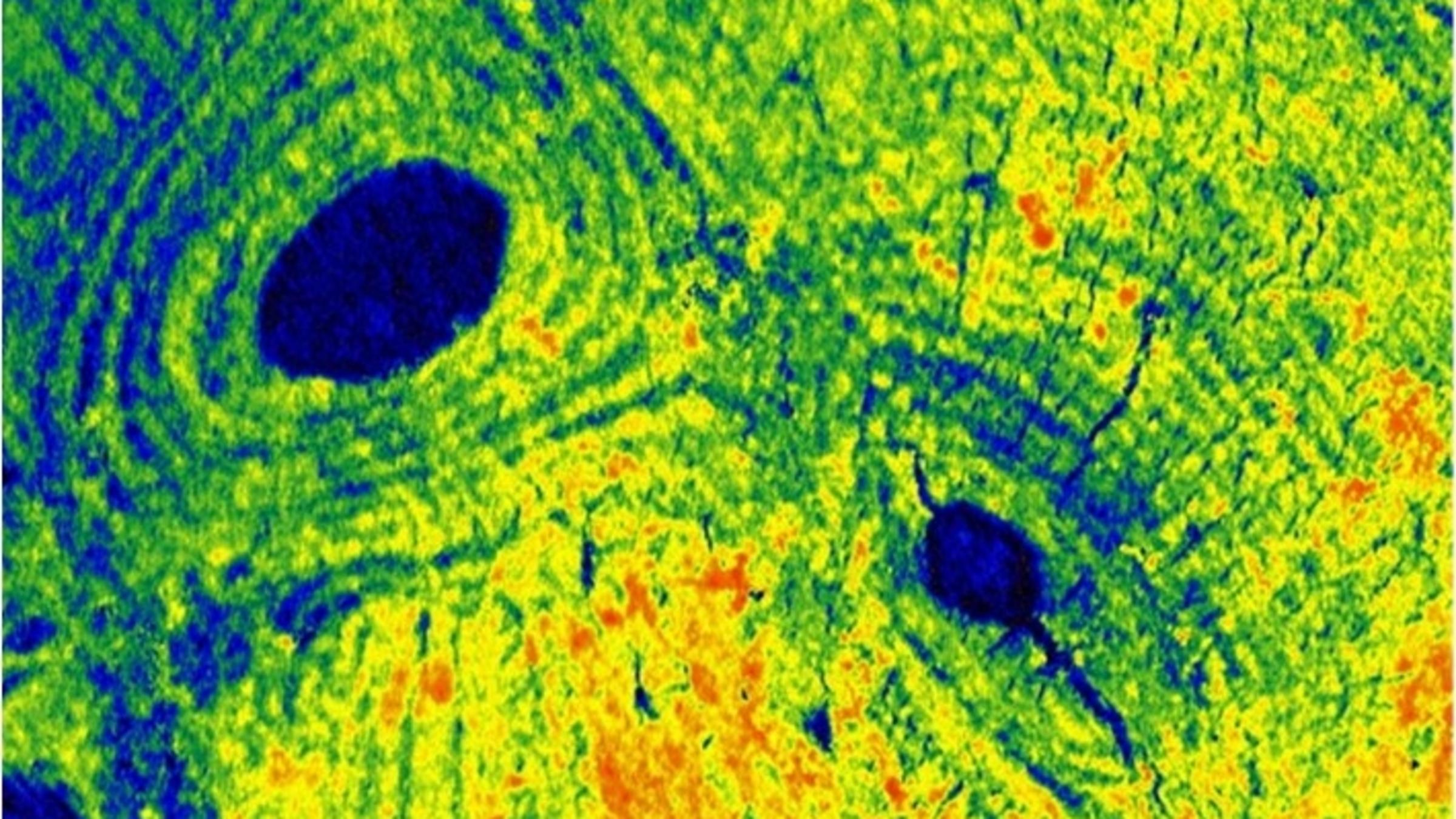 A green, yellow, and orange microscopy image with two blue circles and "ripples" emanating from them.