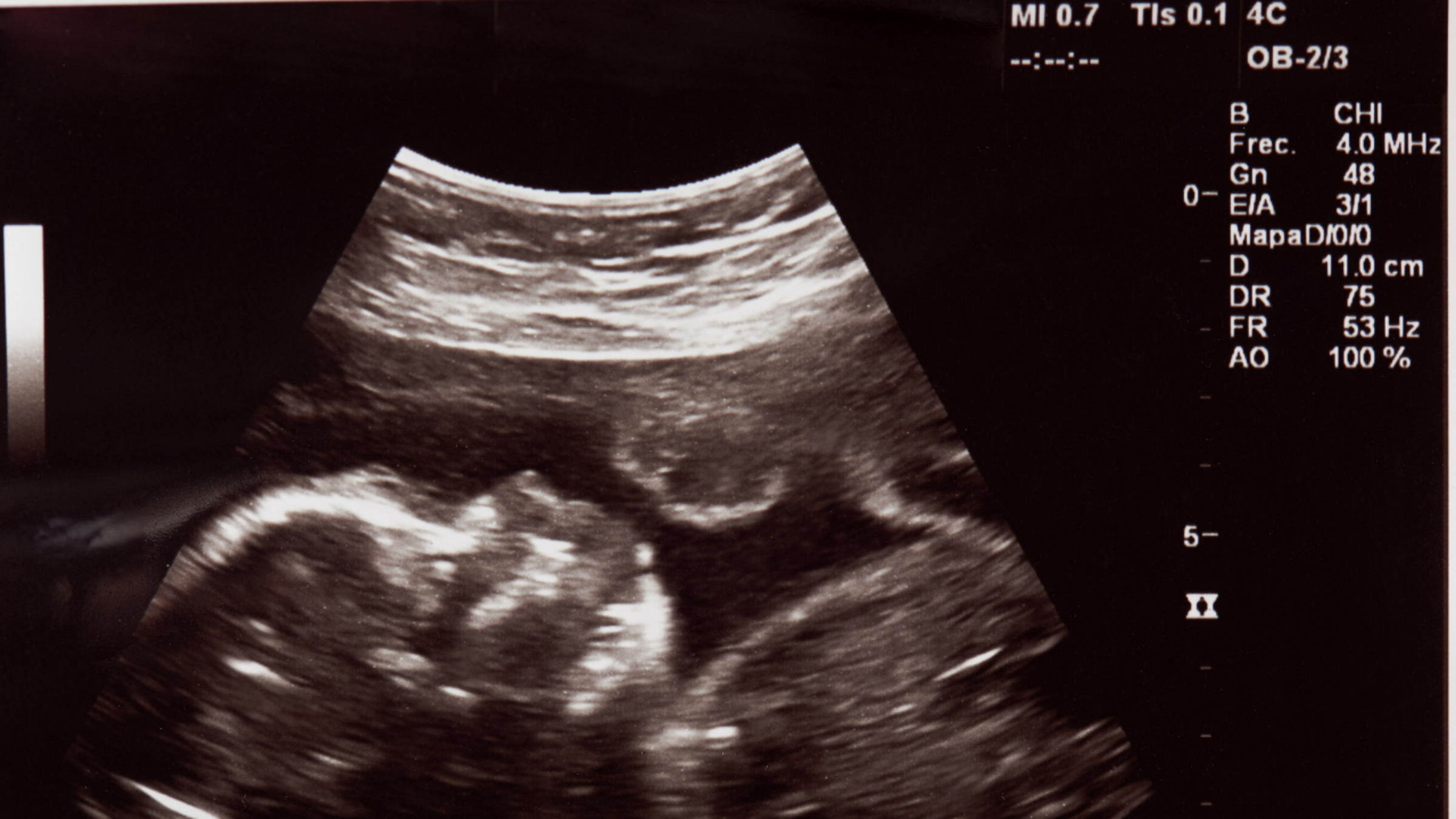 Image of a sonogram