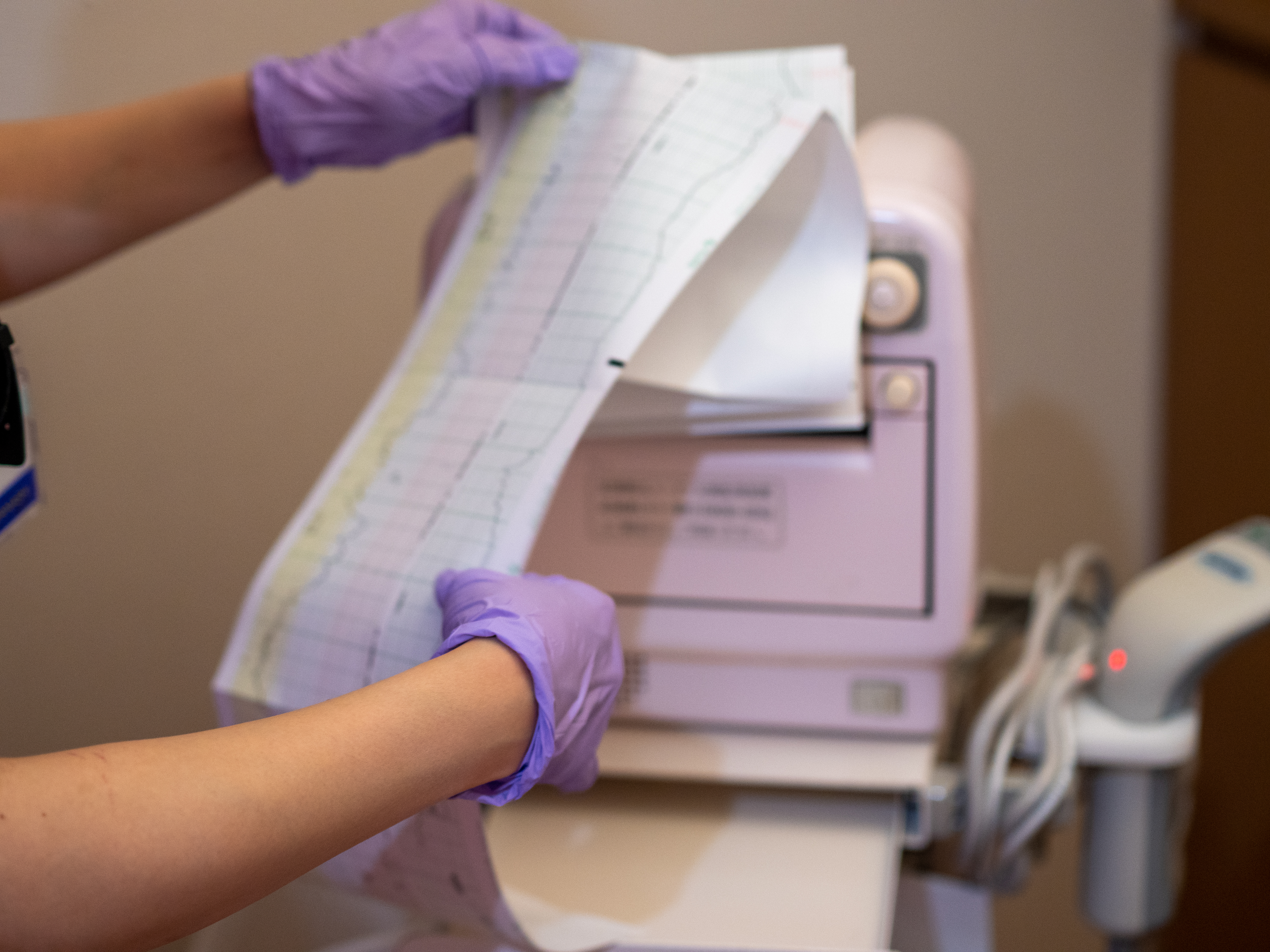 Echocardiogram results