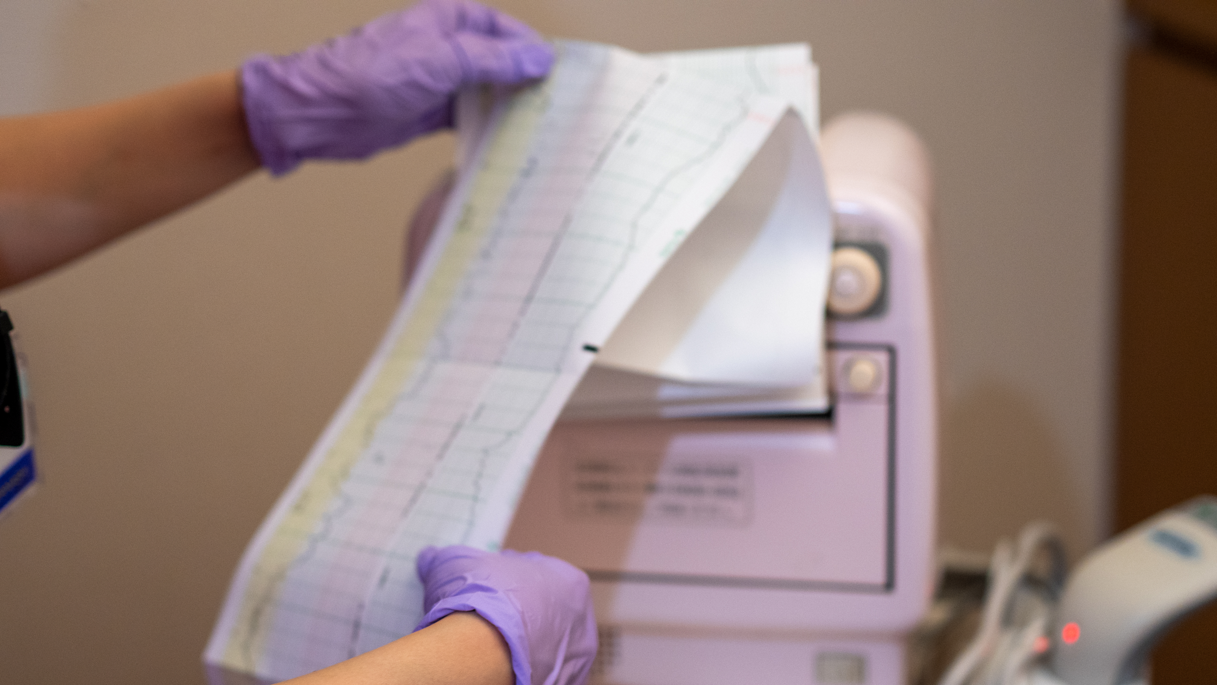 Echocardiogram results