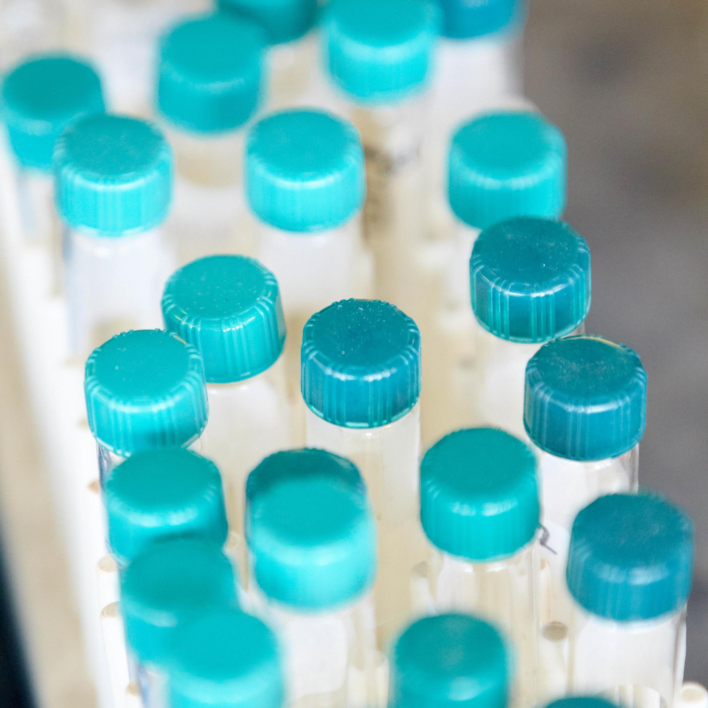 testing tubes with blue caps