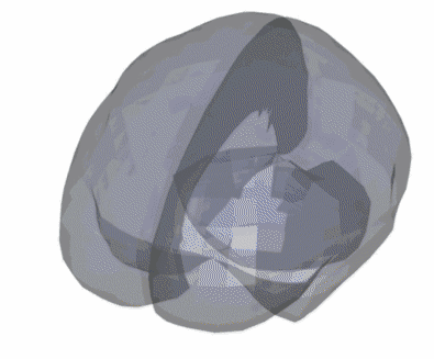 Complex displacement fields in the brain after impact