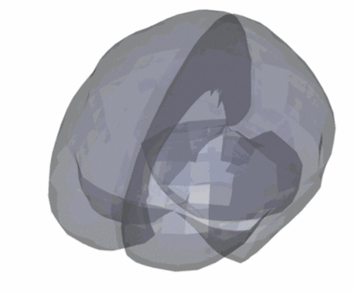 Complex displacement fields in the brain after impact