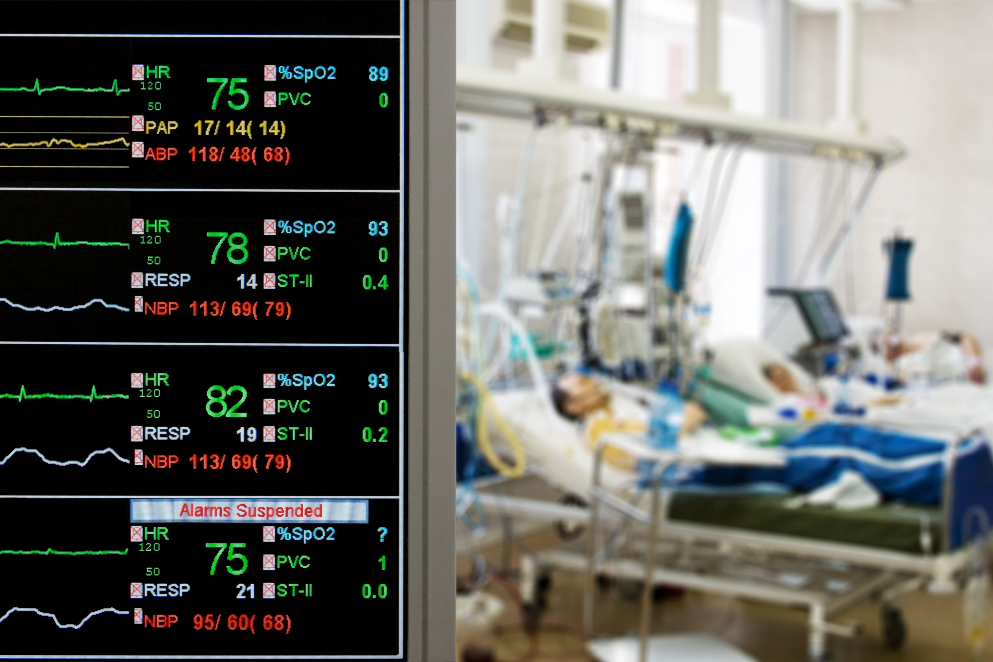 vital signs and ICU room