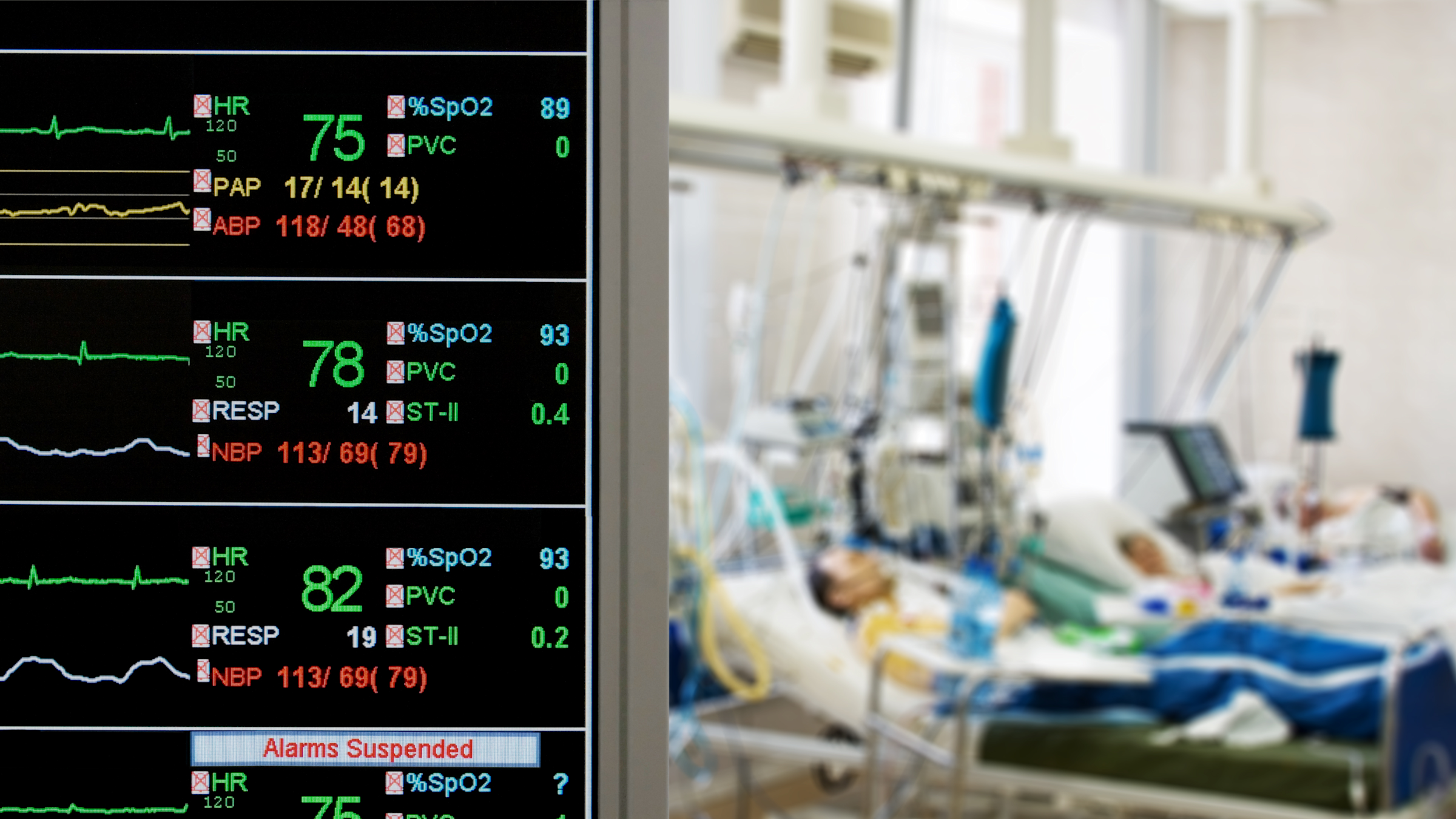 vital signs and ICU room