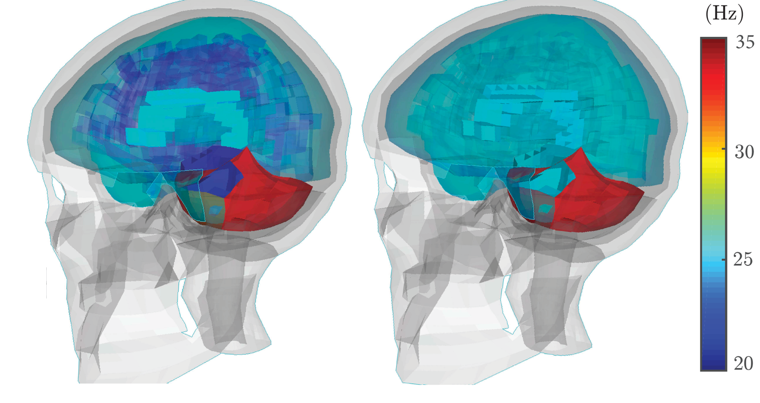 Differences in brain dynamics in injured vs. non-injured athletes. The left side shows the injury; the right side shows a non-injury. CREDIT: KurtLab