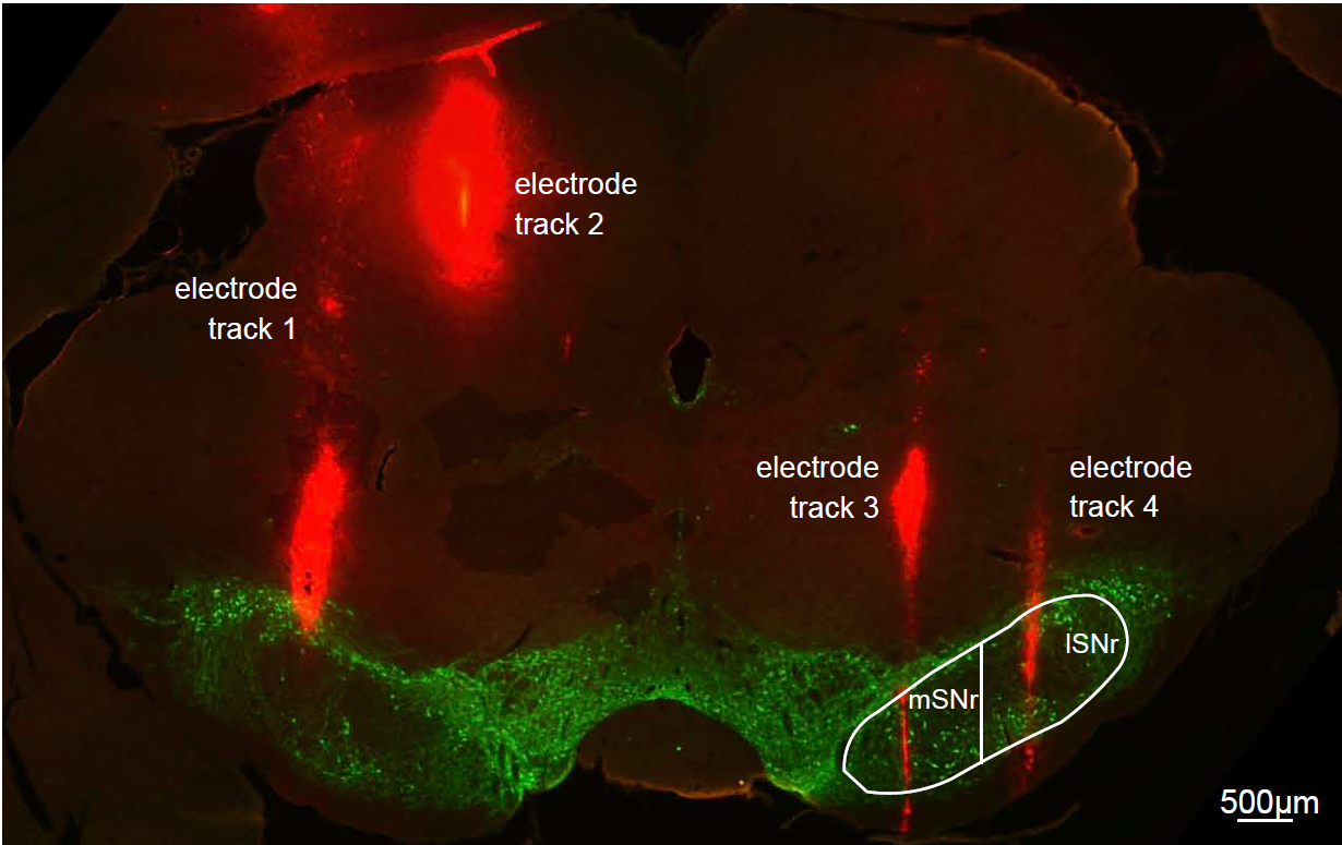 A technique called immunohistochemistry is used to visualize protein expression in the brain following deep brain stimulation. Green indicates dopamine-containing nerve cells and red indicates deep brain stimulation electrode tracks